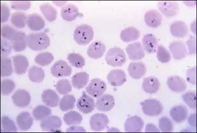 This picture represents :