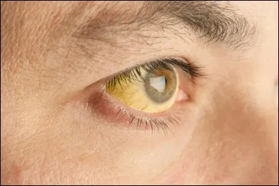 Which animals do sleep with their eyes open?