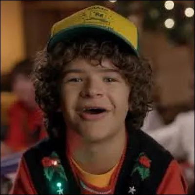 Which of these children has cleidocranial dysplasia?