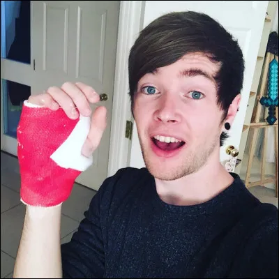How did Dan broke his hand?