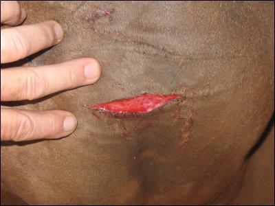 What type of wound is this?