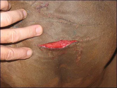 What type of wound is this?