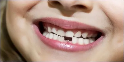 How many baby teeth does a man have?