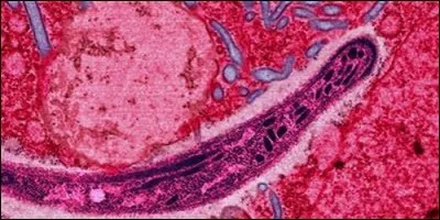 Malaria is a disease caused by: