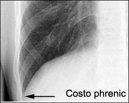 What anatomical part is illustrated in the image?