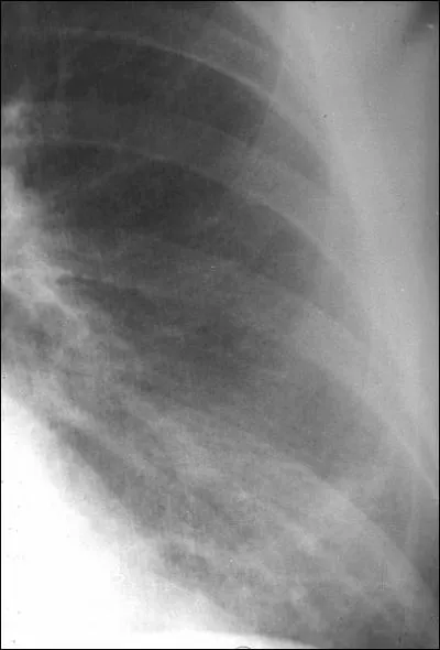 What anatomical part is illustrated in the image?