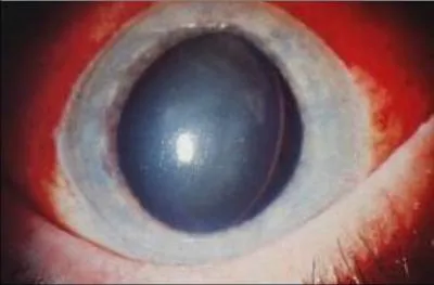 What is the diagnosis?