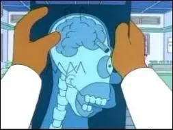 What object got stuck in his brain when he was little ?