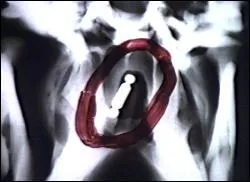 What Episode Is This