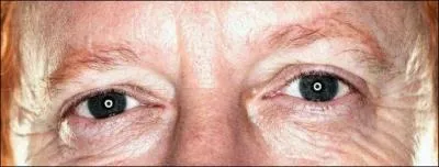 Whose eyes are they?