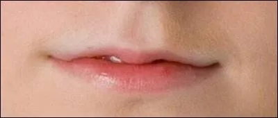 Whose mouth is this?