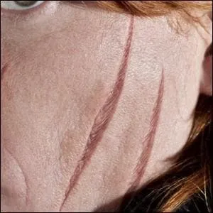 Beautiful scars! Who do they belong to?