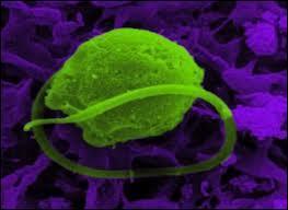 One Cell Algae, What's its kingdom?