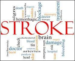 Which part of the body does a stroke affect?