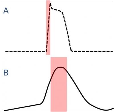 What is the function of the delayed action potential in the AV node, compare to that of a Purkinje Fibre, illustrated below?