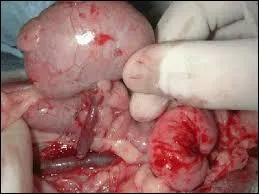 In what ways can doctors counter the immune system to ensure the organ is accepted by the immune system?