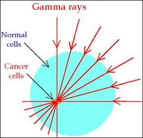 When a diagnosis is made, what is radiotherapy most commonly used to treat?