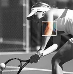 Your ... can become painful if you play tennis for too long.