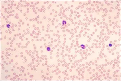 What is the specific C.T tissue shown? What are two types of cells present?