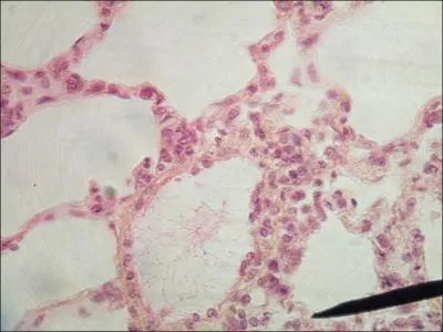 Shown is simple squamous epithelium in the lungs. Why is this type of tissue located in the lungs?