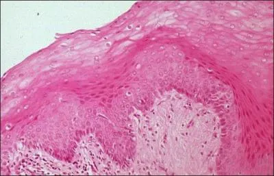 What is the primary tissue type of the outer layer of the skin?