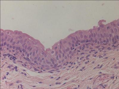 What is the specific tissue type?