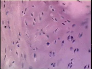 Where is fibrocartilage found?