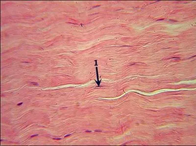 What is the primary tissue, specific tissue, and location of this tissue?