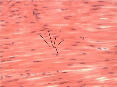 Name the specific tissue.