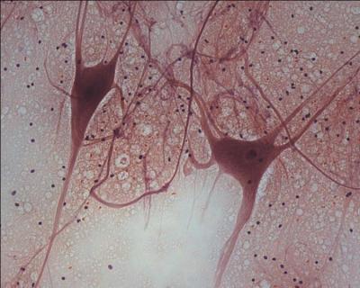 Name the three components of neurons found in nerve tissue.