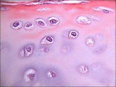 What type of cells sit in the lacunae of cartilage?