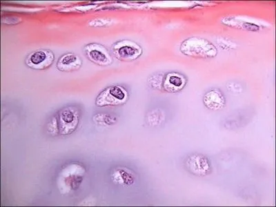 What type of cells sit in the lacunae of cartilage?