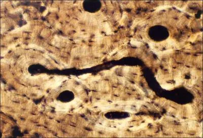What is the specific connective tissue?