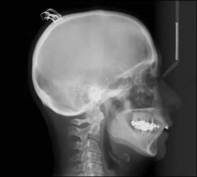 What type of image is this?