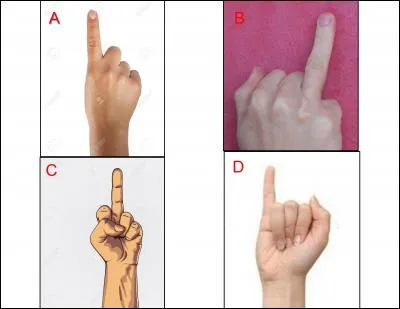 The little finger is represented as: