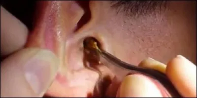 What does the ear secrete?